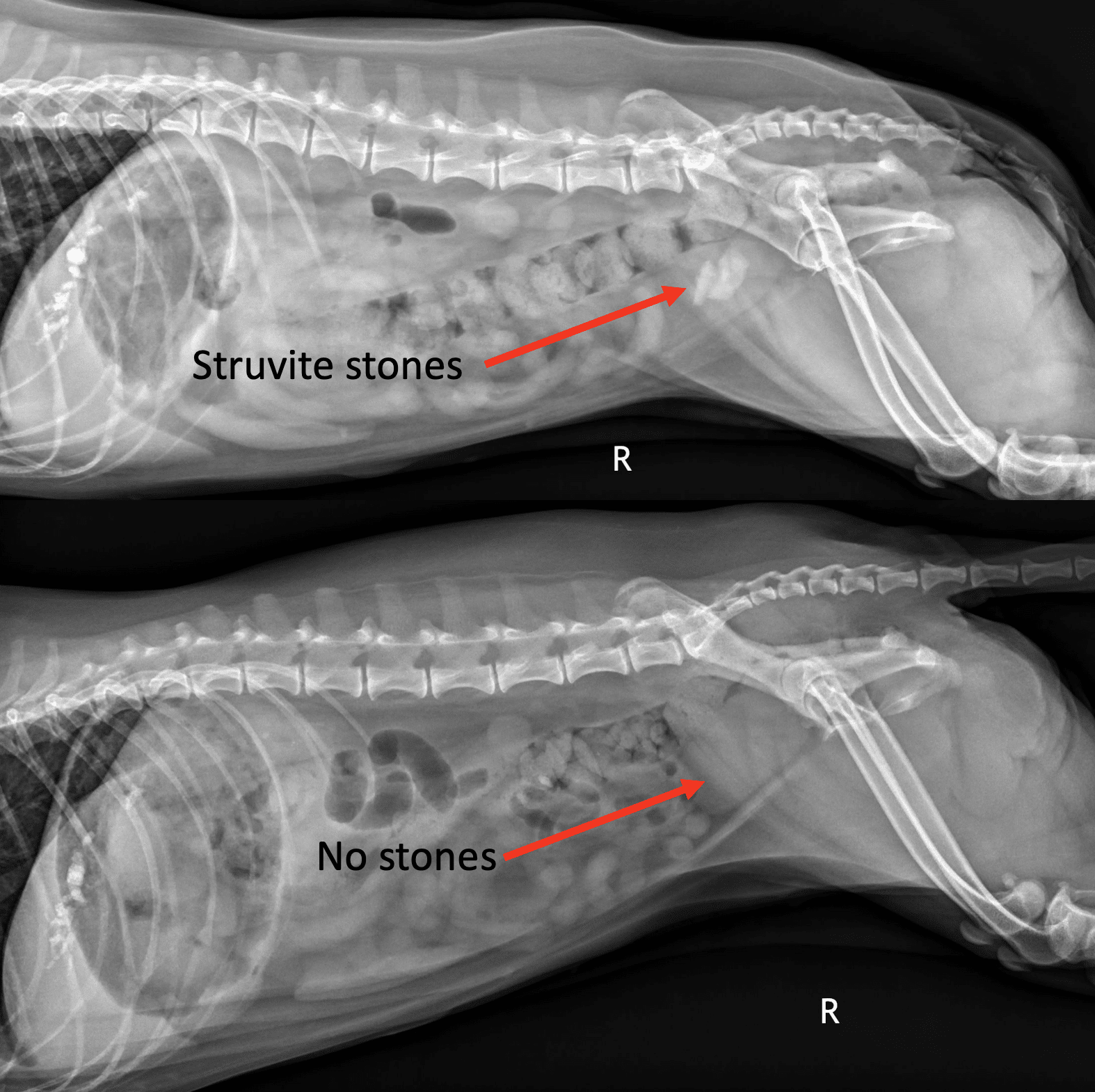 Before-and-after x-rays of successful struvite bladder stone treatment